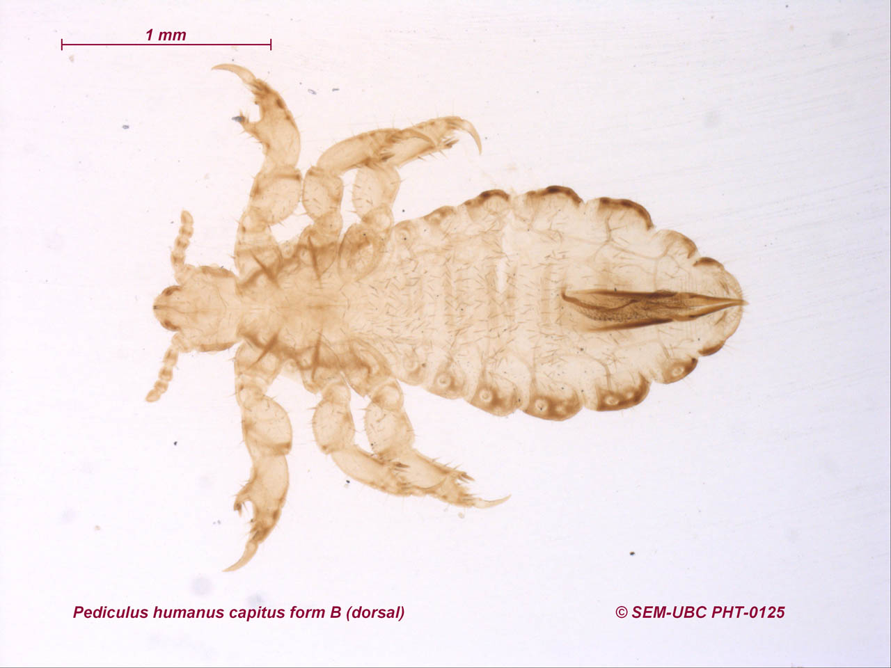 Схема развития pediculus humanus capitis olp