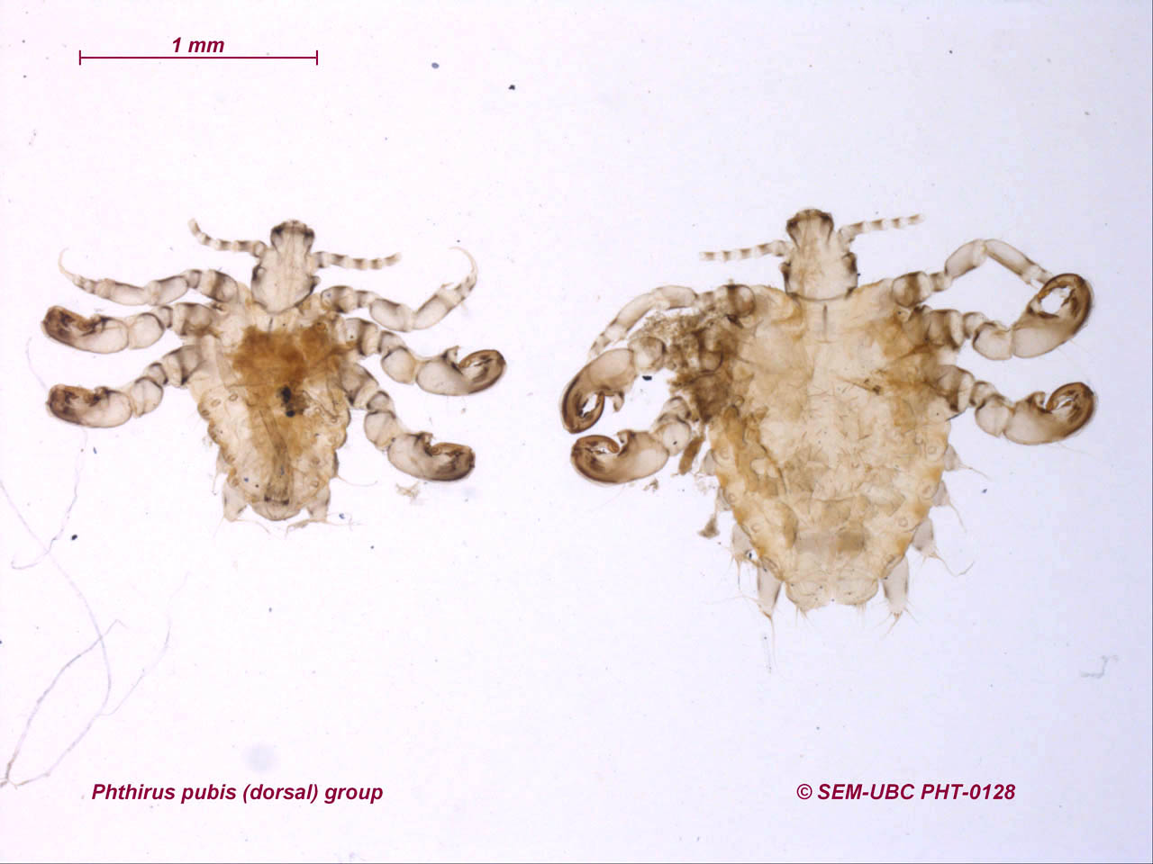 Самка головной вши рисунок. Phthirus pubis строение. Лобковые вши самец и самка.