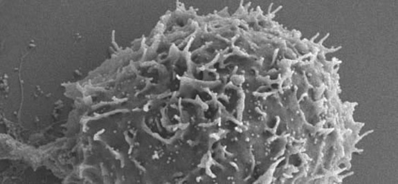 Linda Matsuuchi, Associate Professor, studies immune cell surface receptors responsible for cell activation. This photo of a B lymphoma cell, an essential player in our immune systems, was taken with a scanning electron microscope. Photo: Saba Sebatien
